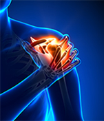 Shoulder Fracture Treatment
