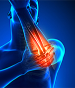 Arms/Elbows Injury Treatment