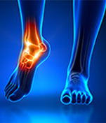 Feet/Ankles Fracture Treatment