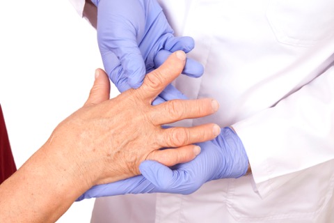 Doctor examining a hand