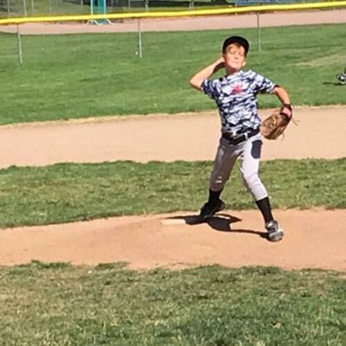 Little League Elbow
