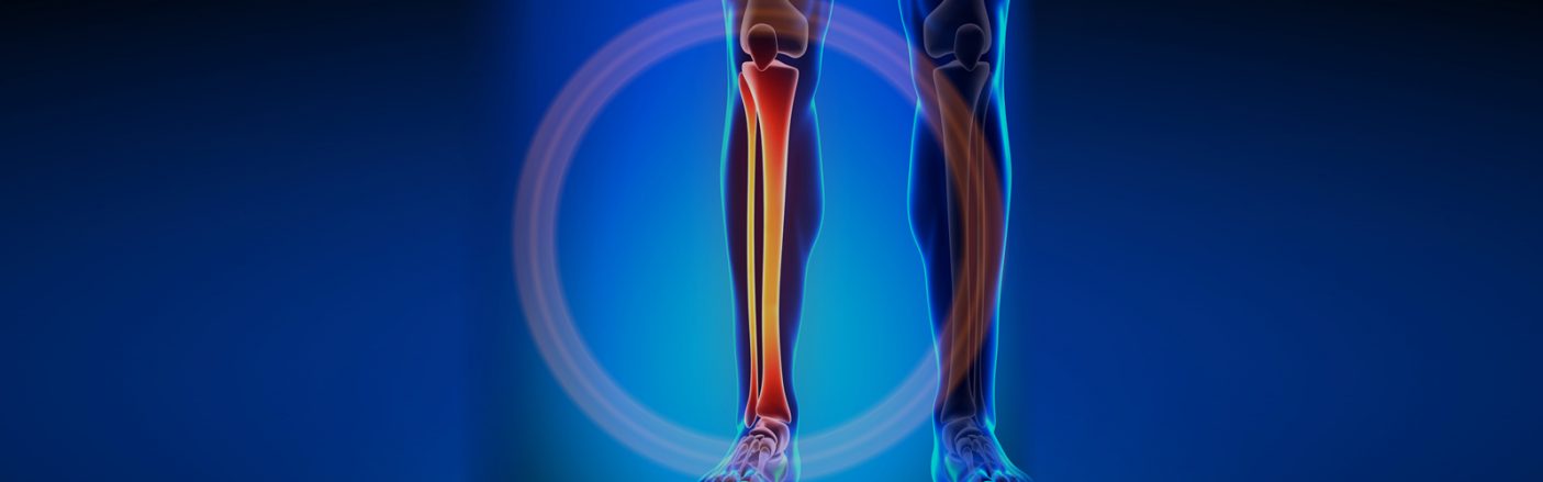 Orthopedic Leg Doctor | Direct Orthopedic Care (DOC)