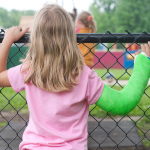 Young Girl with a broken arm