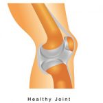 partial vs total knee replacement surgery